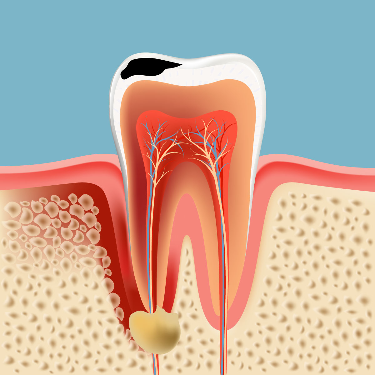 Root Canal Dentist in Orange CA. – Dr Ronald Pham DDS Root Canal Dentist in Orange CA. - Dr Ronald Pham DDS