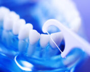 How-to-Floss-All-on-4-Dental-Implants
