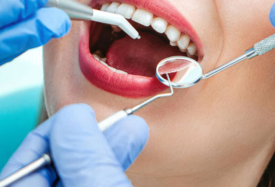 What Type of Sedation is Used for Dental Implants