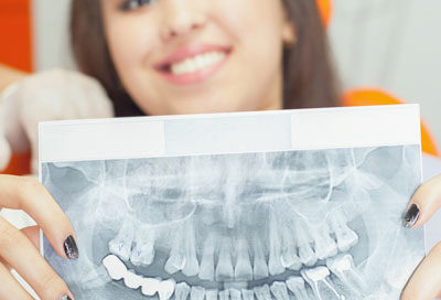 What do dental implants look like