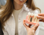 When is it too Late for Dental Implants? Age, Bone Loss, or overall health.