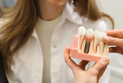 When is it too Late for Dental Implants? Age, Bone Loss, or overall health.