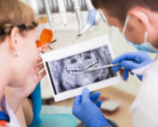 How long before dental implants feel normal?