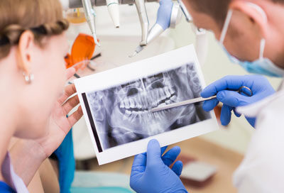 How long before dental implants feel normal?