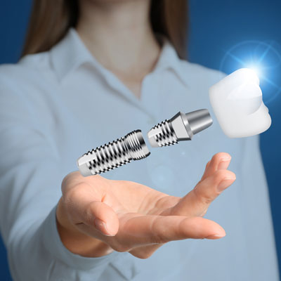 Why Do Dental Implants Cost So Much
