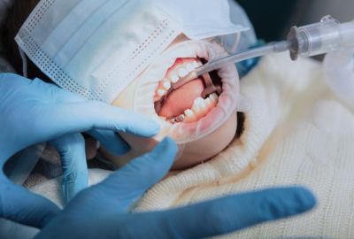 Anesthesia in dental implant surgery feels