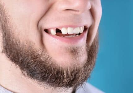 case studies 3 images before dental implants