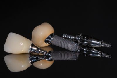 Ceramic crown on implants