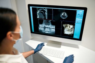 Dental x rays