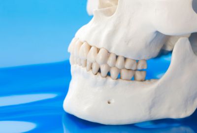 Jawbone density is a factor that affects the success of mini-implants