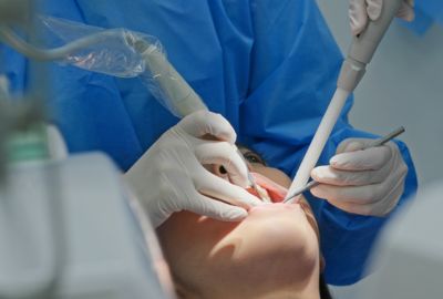 Sounds of the drill in dental implant surgery