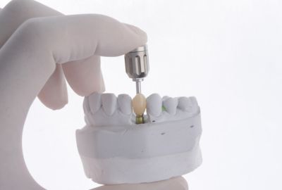 The type of implant used affects the cost.