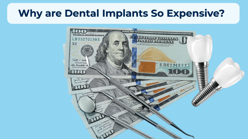 Visual representation of why dental implants are expensive, featuring dental tools, implant models, and hundred-dollar bills highlighting the high cost of implant procedures.