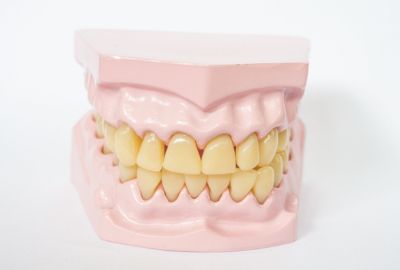 Full-mouth restoration requires multiple crowns