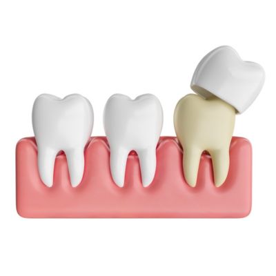 how many dental crowns does the average person have