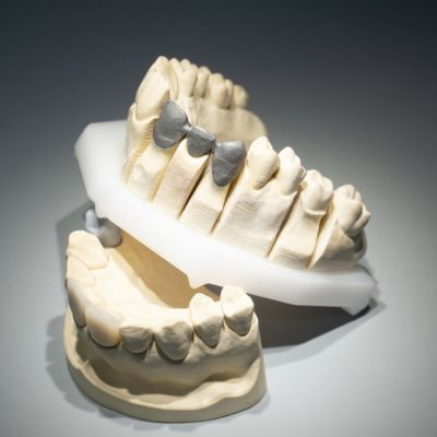 What is the best crown material for front and back teeth