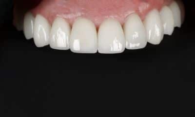 Dental crowns help enhance the appearance