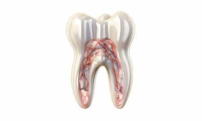 Dental crowns risk of nerve damage