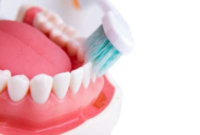 Soft-bristled toothbrush helps remove dental cement. 