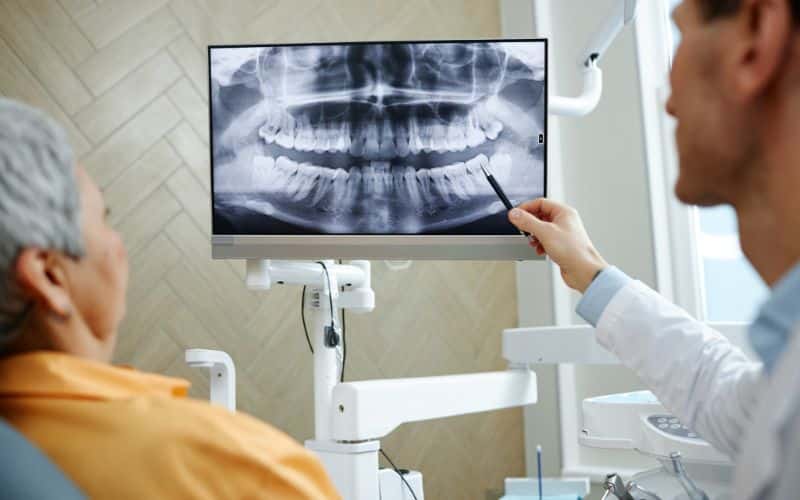 Diagnostic imaging costs are important for implant planning