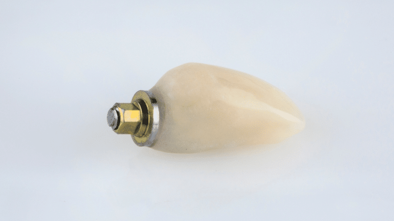 Close-up of a resin temporary dental crown on molar tooth with dull surface and rounded shape.