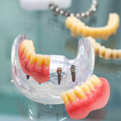 How much does a mini dental implant cost?
