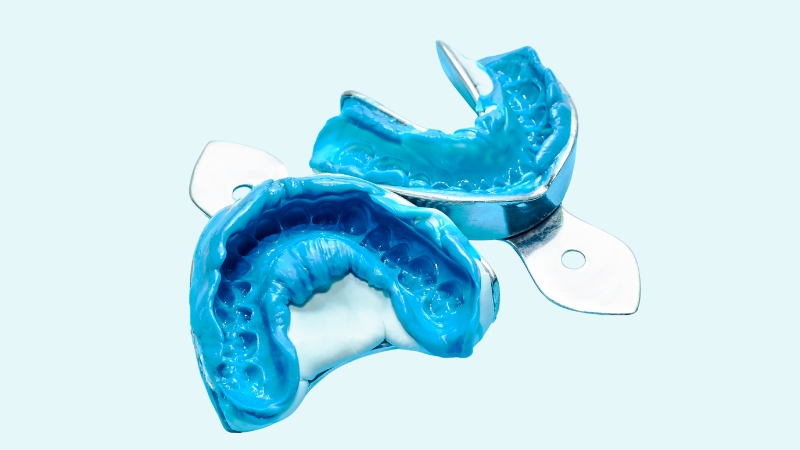 Precise dental impressions in blue material are used by technicians to replicate the exact shape and size of a patient's teeth for a natural-looking dental bridge.
