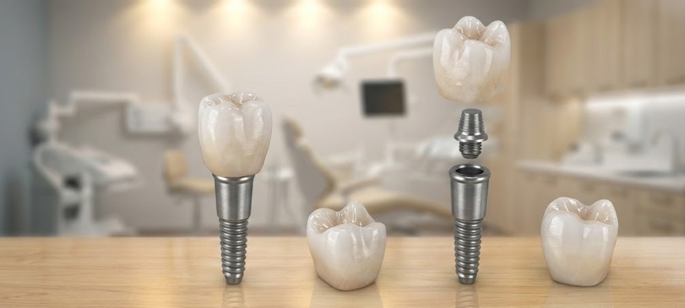 A display of custom-designed, high-grade ceramic dental crowns that mimic the translucency of natural enamel, used to restore the structural integrity and chewing function of damaged teeth.