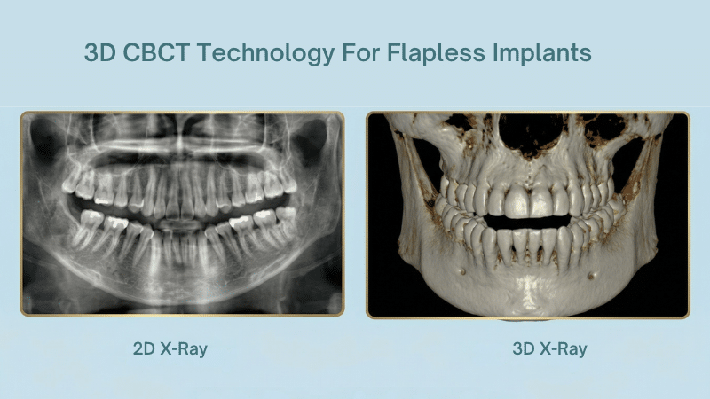 A side-by-side visual comparison between a traditional flat 2D X-ray and a detailed volumetric 3D CBCT scan of a jawbone, demonstrating the advanced imaging technology used for safe and precise flapless dental implant surgery planning in Orange County.