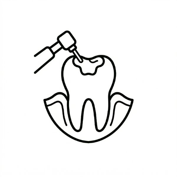 Tooth Fillings