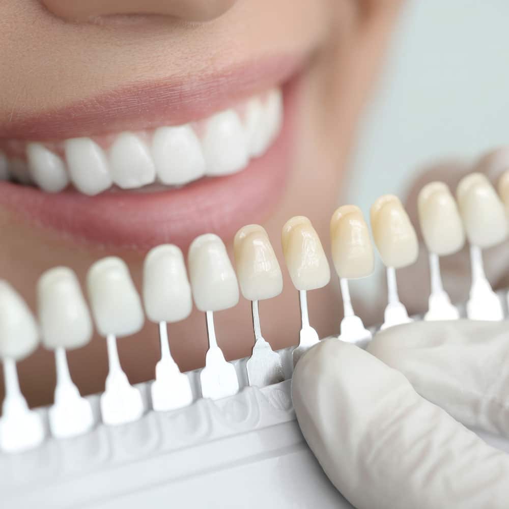 Esthetic Dental Crowns and Cosmetic Dentistry in Orange CA by Restoration Dental OC