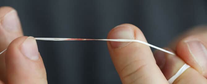 Why do my gums bleed when flossing?