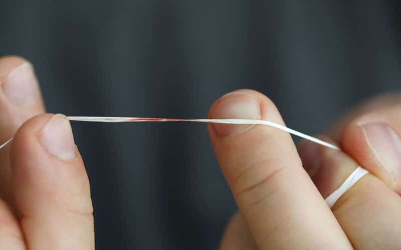 Restoration Dental: Why do my gums bleed when flossing?